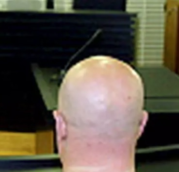 Orren tapaus.jpg