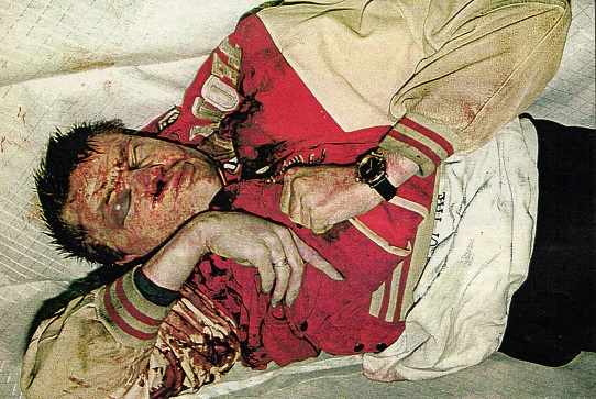 Jack Morren ruumis peitteiden poistamisen jälkeen. Kasvoissa näkyvät vammat ovat takaraivoon ammutun luodin aiheuttamia.