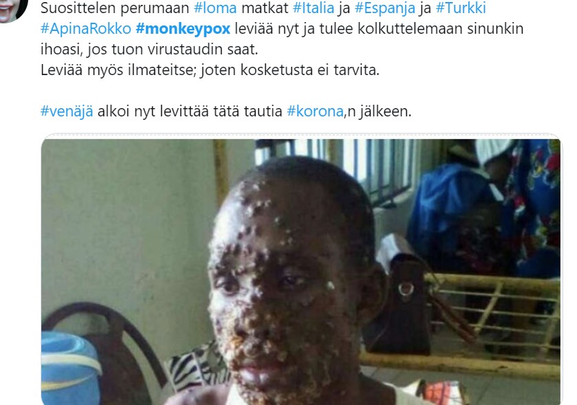 apinarokko.jpg