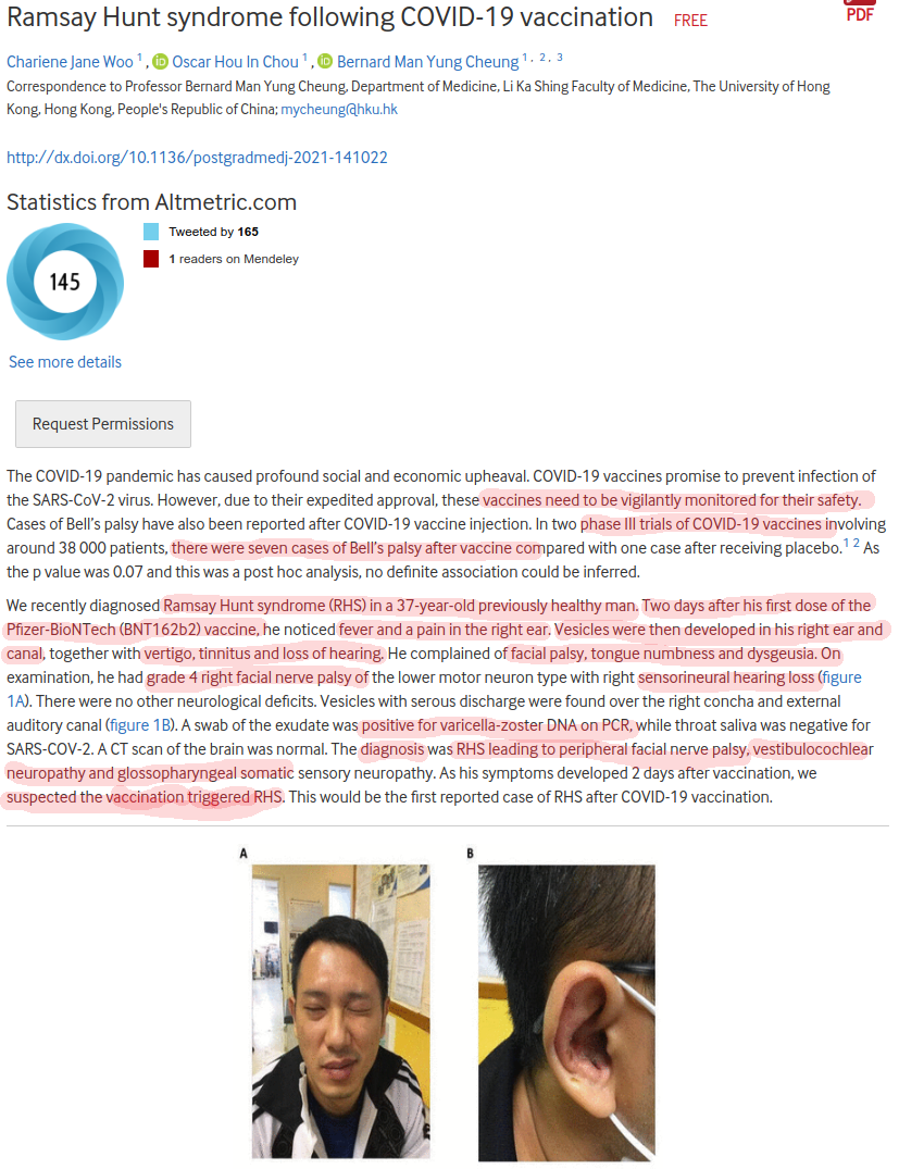 RHS 37-vuotiaalle terveelle miehelle 2 päivää pfizer-injektiosta.png
