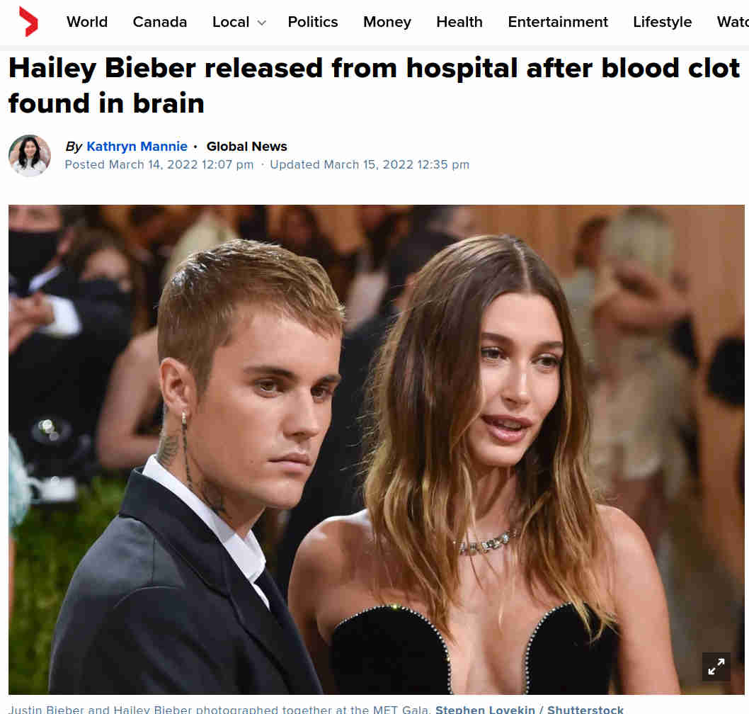 Hailey Bieberillä todettiin keväällä veritulppa aivoissa.jpg