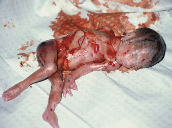 Screenshot 2024-03-17 at 17-11-52 Abortion Pictures.png