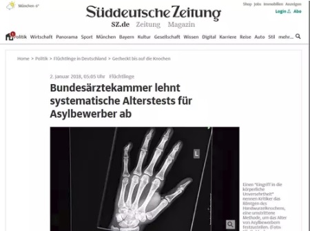Ikätestit perustuvat tyypillisesti luiden röngentutkimuksiin. Kuvakaappaus sanomalehti Süddeutsche Zeitungin verkkosivuilta.