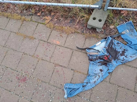 Uhri sai nopeasti ensiapua. Veriset housut jäivät tapahtumapaikalle.jpg