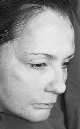 Malmilla 2004 paloitellun uhrin pää.jpg