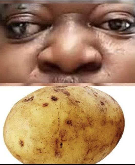 Pottunokka