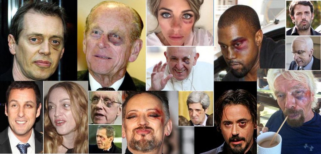 celeb-black-eyes-1024x493-3977021422.jpg