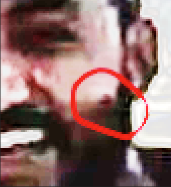 Huijarin vasen poski.png