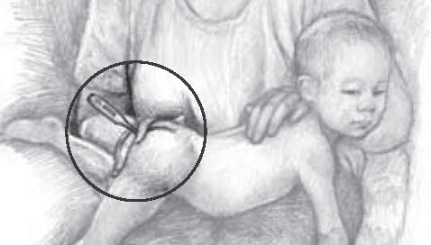 Rectal_temp_1.jpg