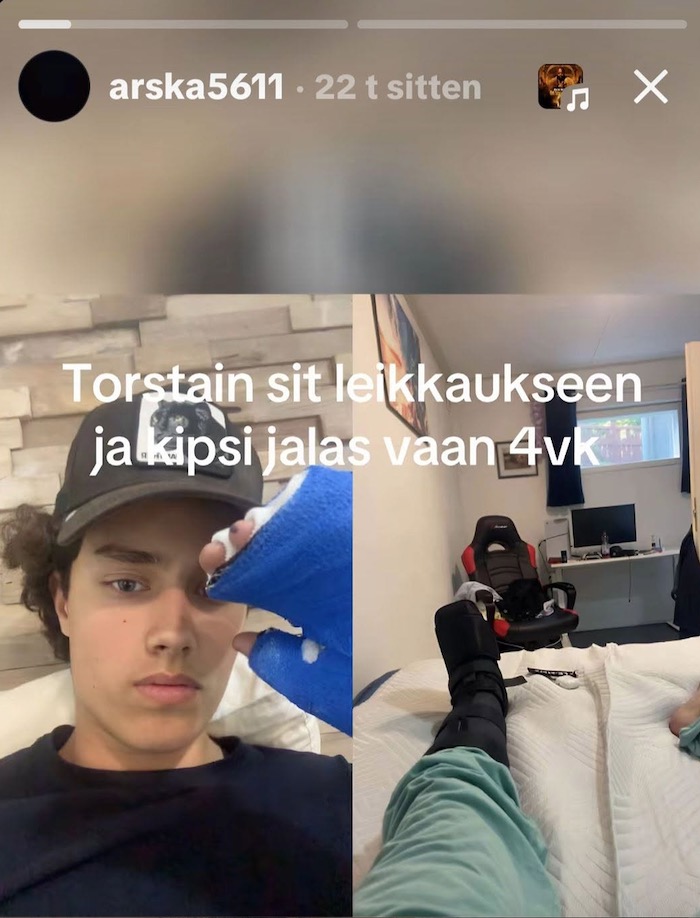 Arska_kipsi.jpg
