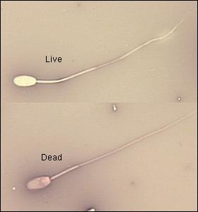 livedead.jpg