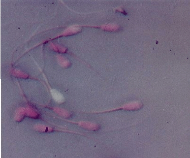 Live-no-color-and-dead-red-sperms-under-a-light-microscope-with-400-x-magnification(1).jpg