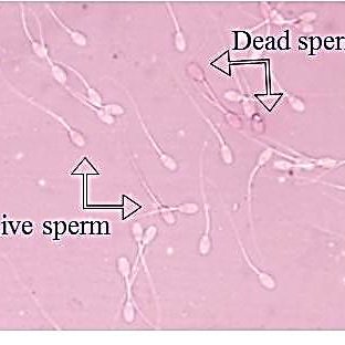 Viability-test-by-Eosin-nigrosin-stain_Q320.jpg