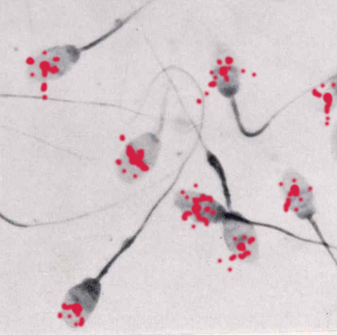 Dead_sperm.jpg