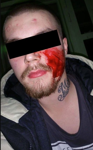 Jyväskylässä pahoinpidelty.jpg